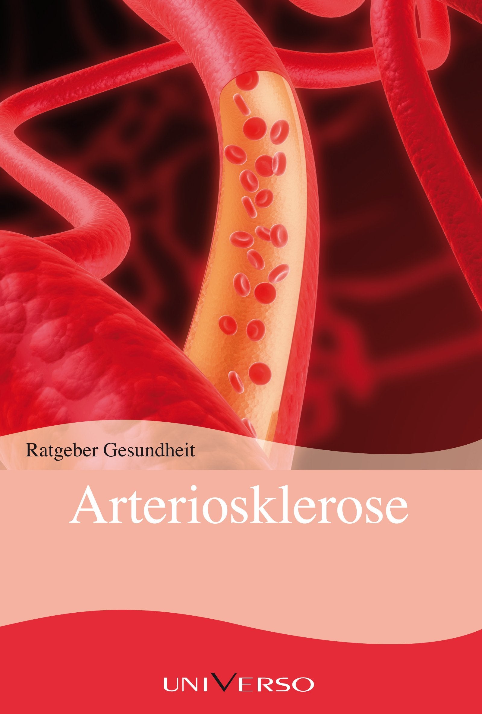 Ratgeber Gesundheit - Arteriosklerose Books