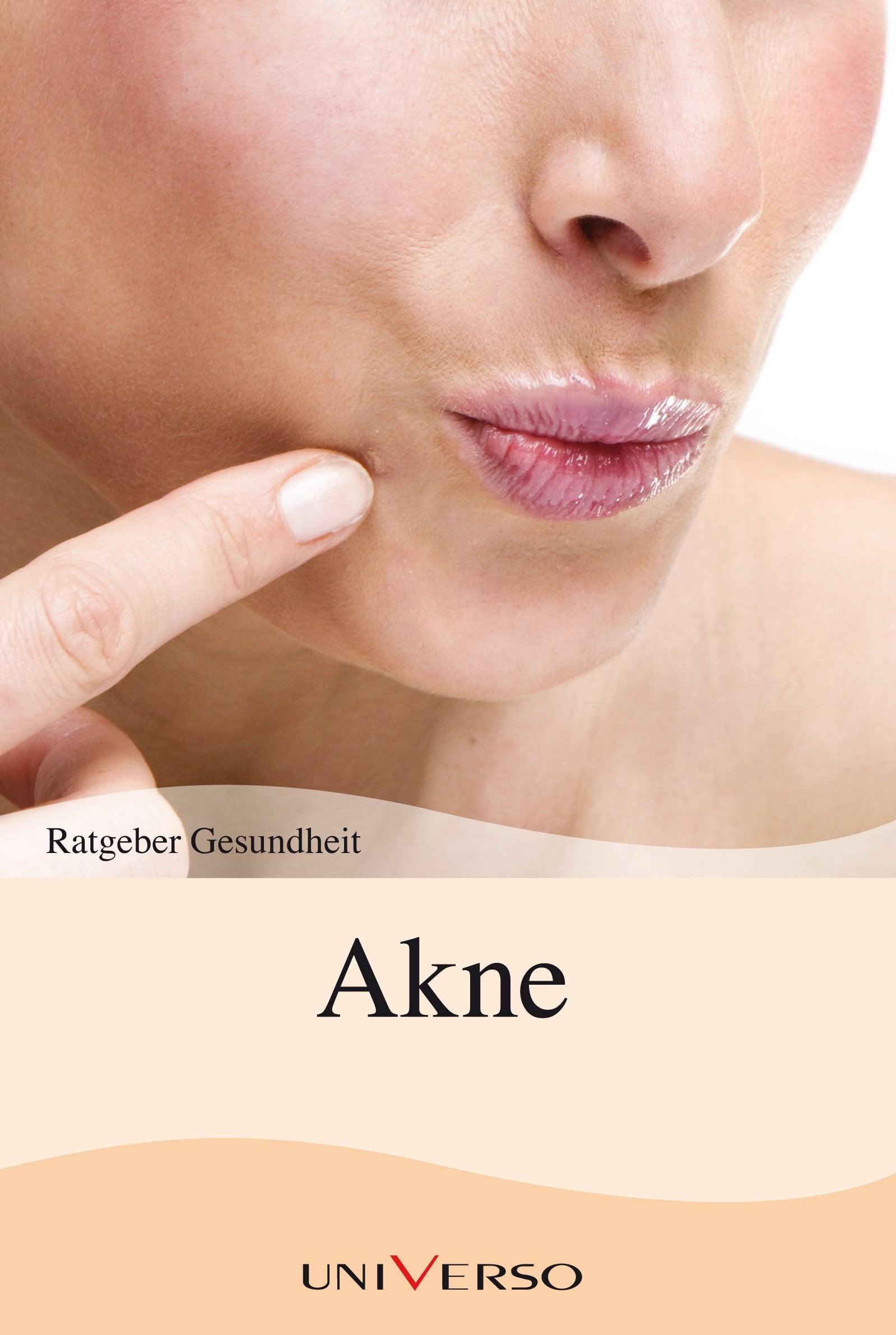 Ratgeber Gesundheit - Akne Books