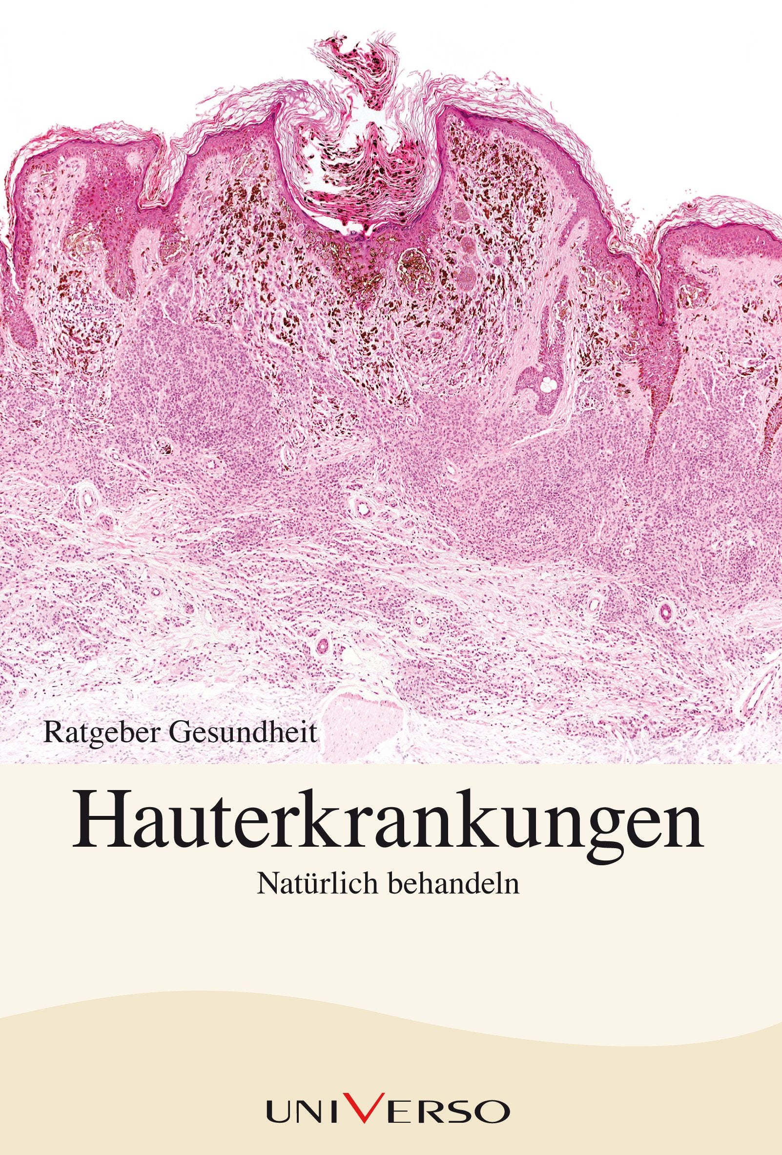 Ratgeber Gesundheit - Hauterkrankungen Natürlich behandeln book