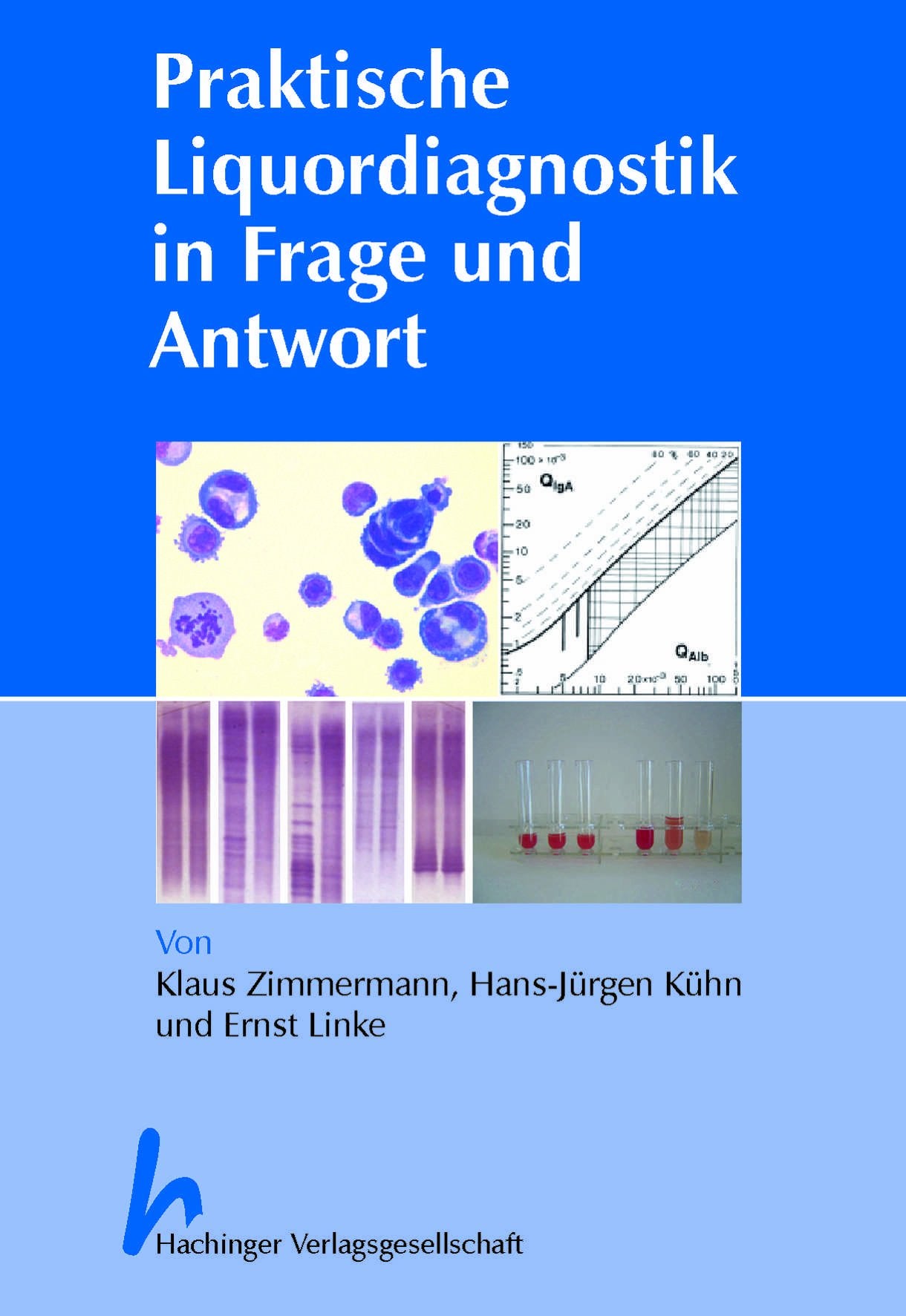 Praktische Liquordiagnostik in Frage und Antwort Books