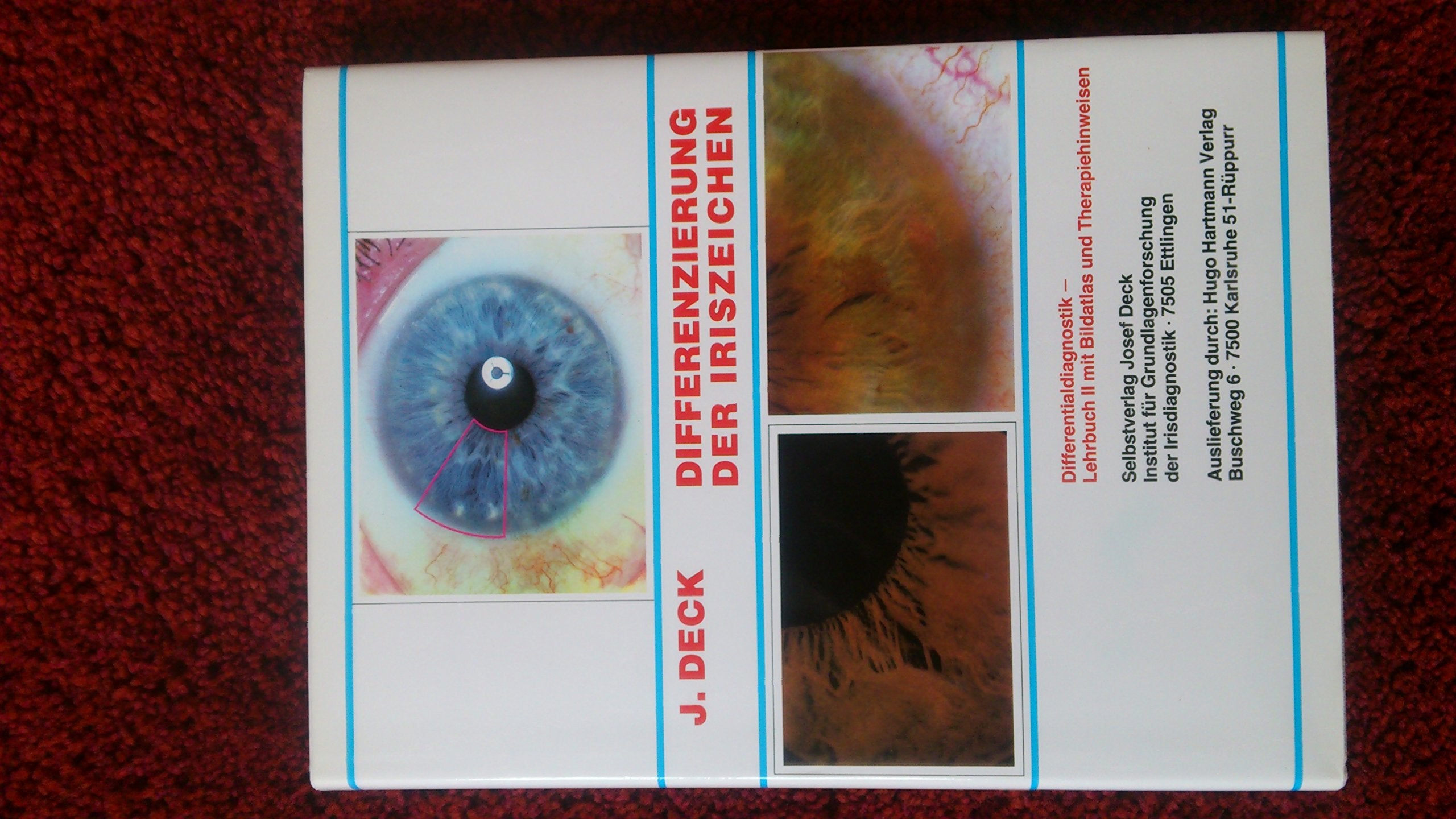 Product Image: Differenzierung der Iriszeichen. Lehrbuch mit Therapiehinweisen.