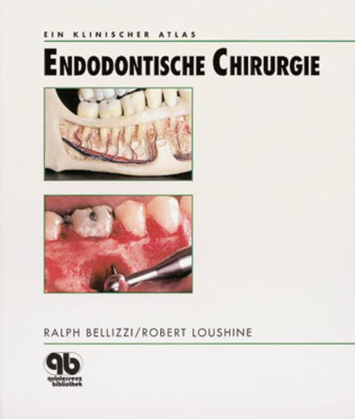 Endodontische Chirurgie: Ein klinischer Atlas Medicine