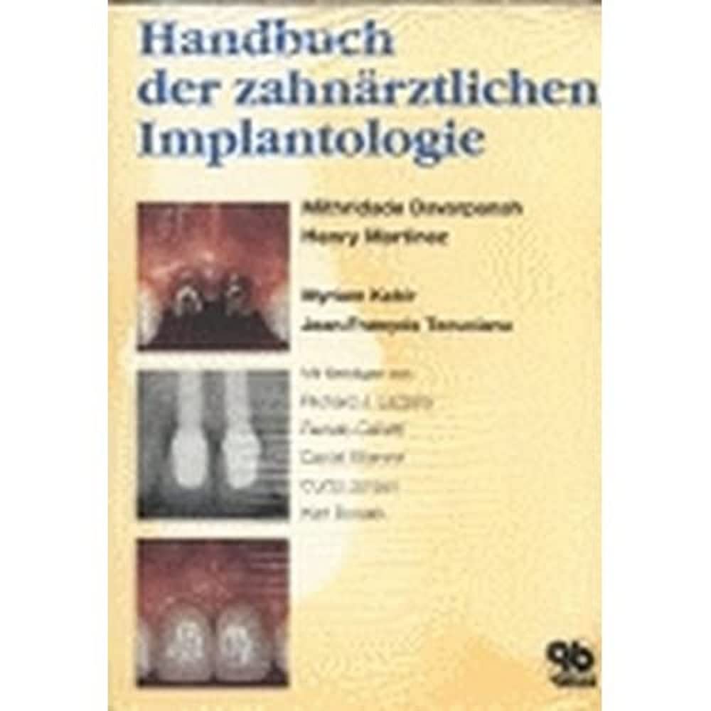 Handbuch der zahnärztlichen Implantologie Medicine