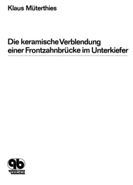Die keramische Verblendung einer Frontzahnbrücke im Unterkiefer Medicine