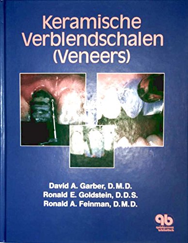 Keramische Verblendschalen (Veneers): Bearb. v. Siegward Heintze. Medicine