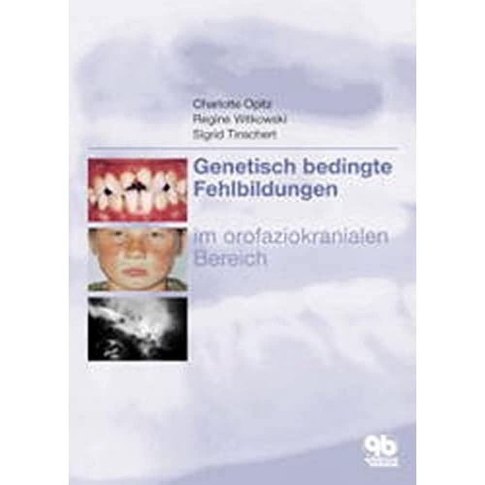 Genetisch bedingte Fehlbildungen im orofaziokranialen Bereich book