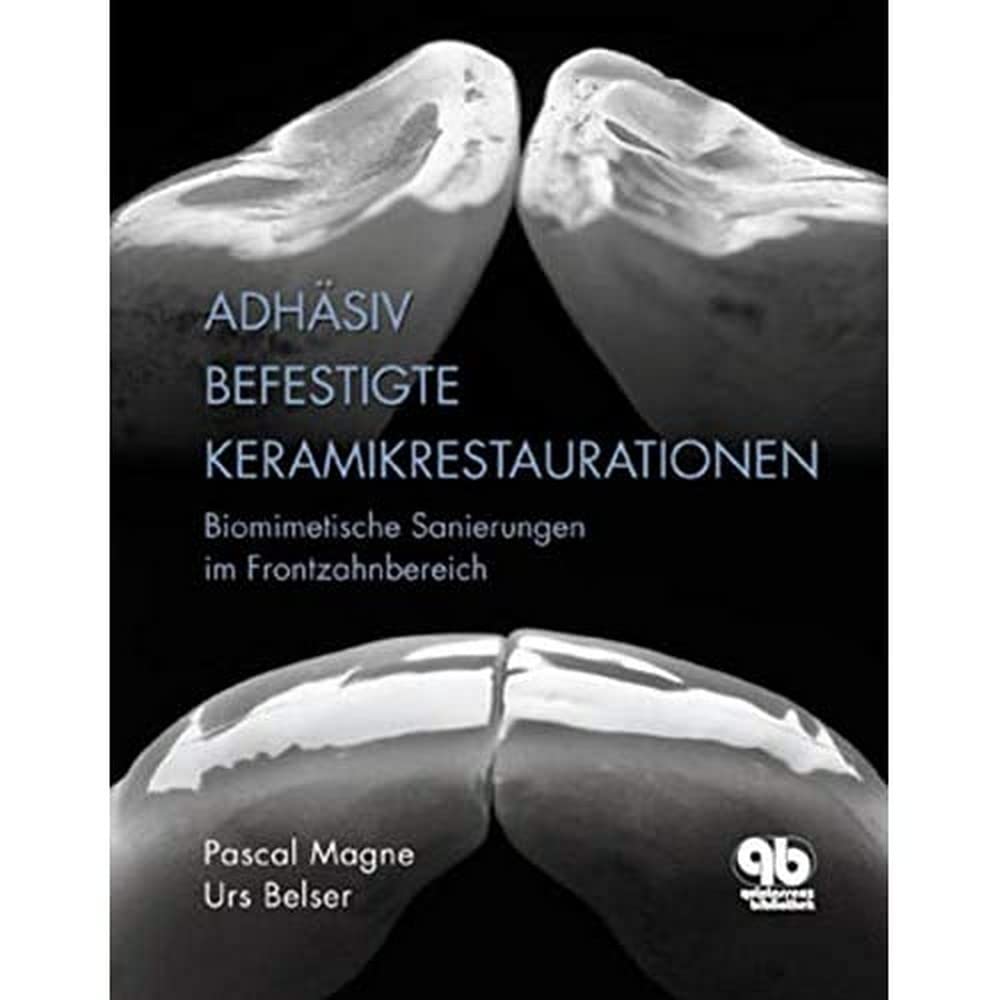 Adhäsiv befestigte Keramikrestaurationen: Biomimetische Sanierungen im Frontzahnbereich Medicine