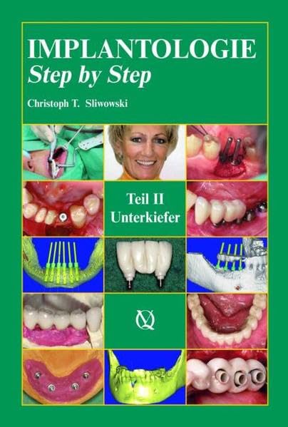 Implantologie Step by Step: Band 2: Unterkiefer Medicine
