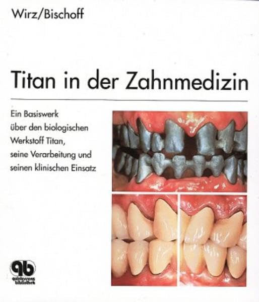 Titan in der Zahnmedizin Medicine