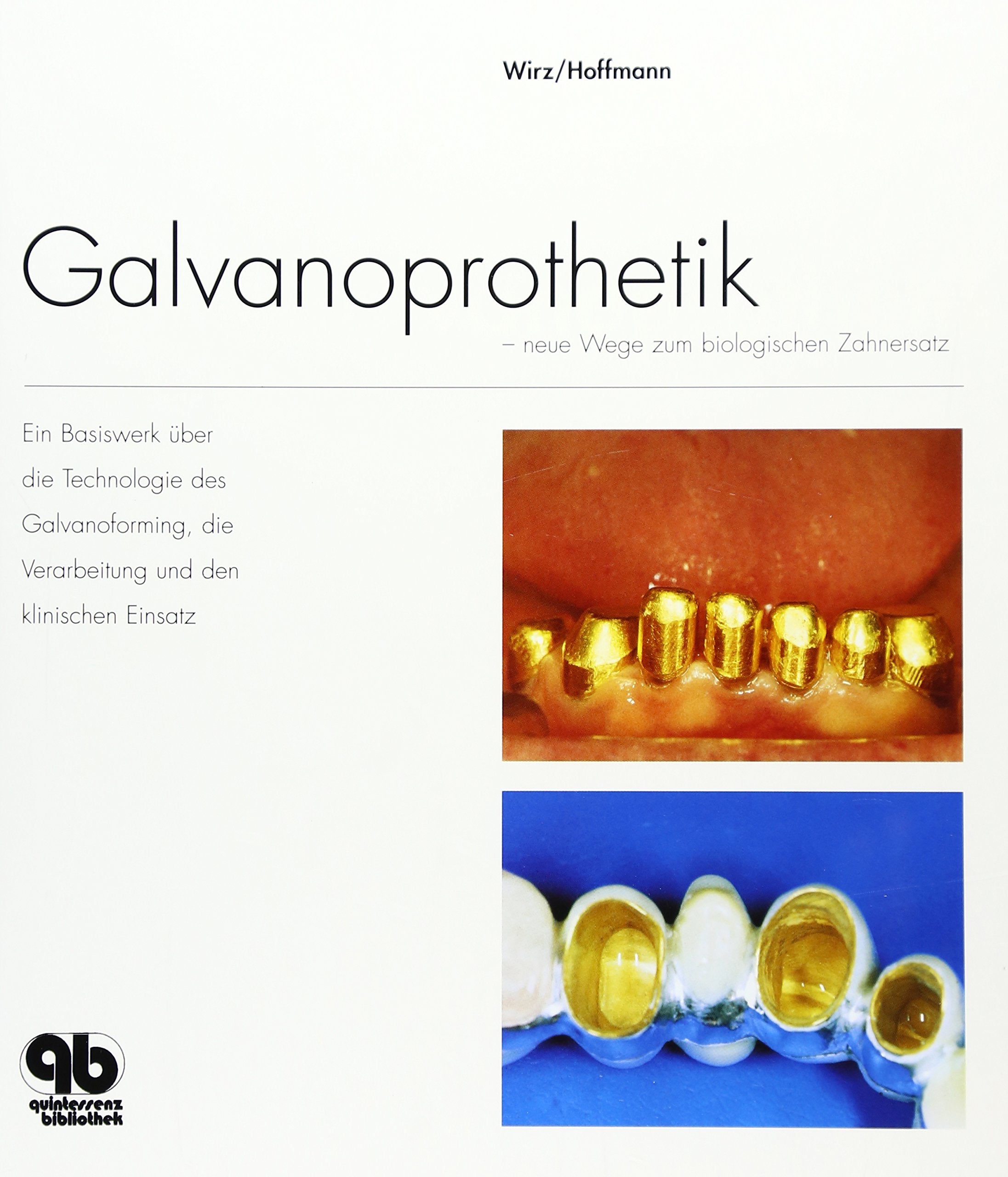 Galvanoprothetik: Neue Wege zum biologischen Zahnersatz Medicine