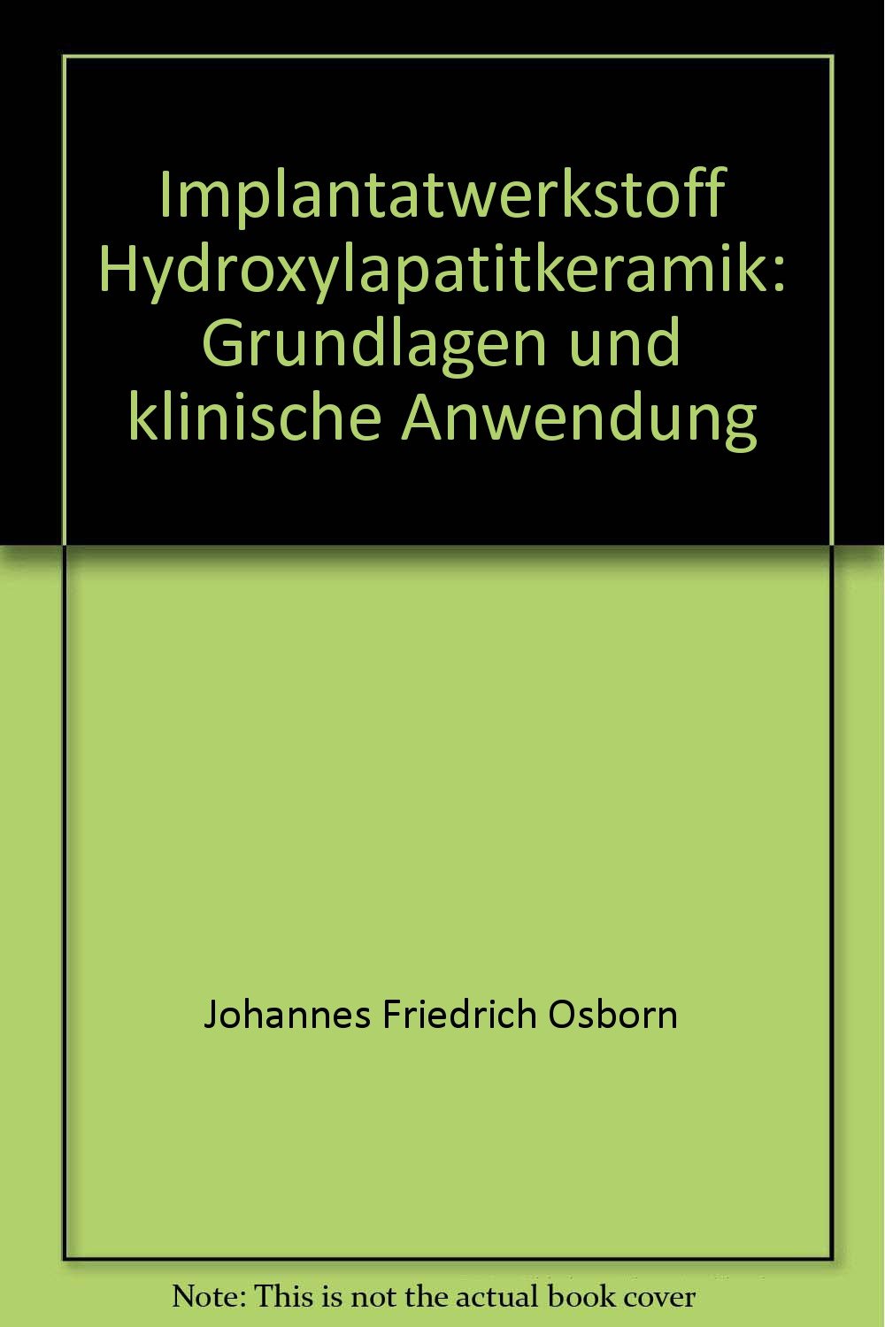 Implantatwerkstoff Hydroxylapatitkeramik: Grundlagen und klinische Anwendung book