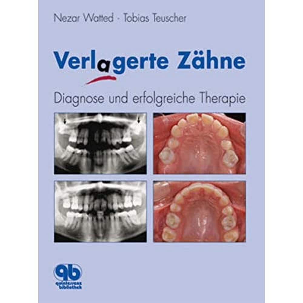 Verlagerte Zähne: Diagnose und erfolgreiche Therapie Medicine