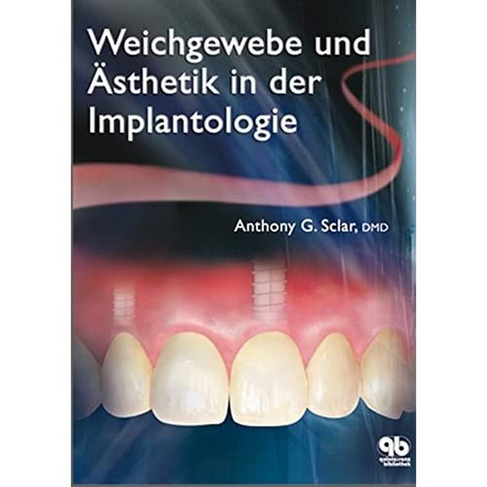 Weichgewebe und Ästhetik in der Implantologie Medicine