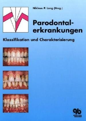 Parodontalerkrankungen: Klassifikation und Charakterisierung Medicine