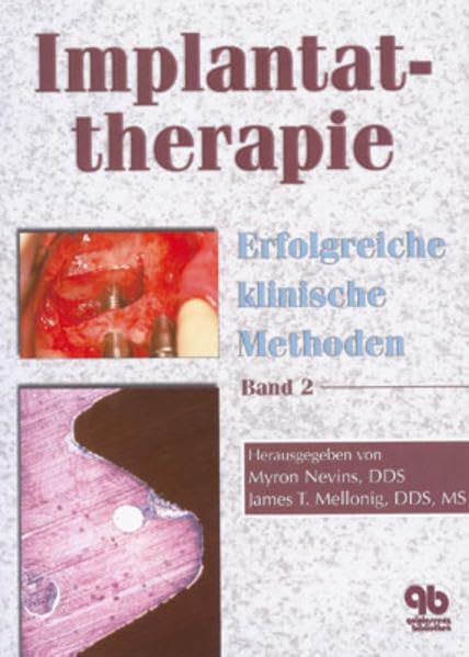 Implantattherapie. Erfolgreiche klinische Methoden 2. Medicine