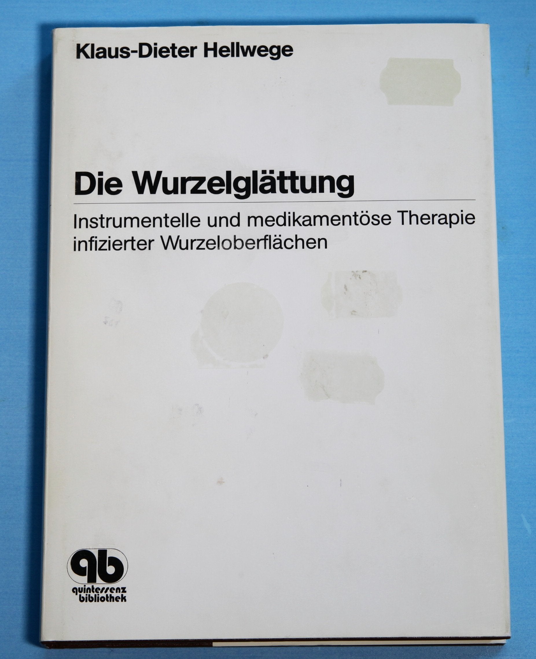 Die Wurzelglättung: Instrumentelle und medikamentöse Therapie infizierter Wurzeloberflächen Medicine