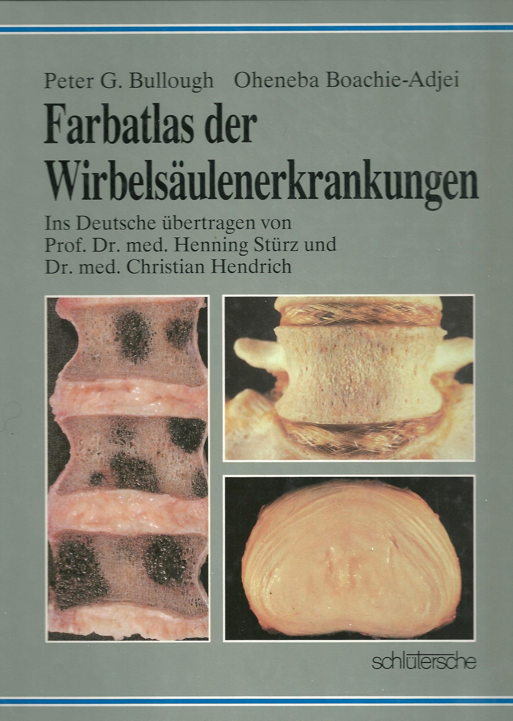Farbatlas der Wirbelsäulenerkrankungen Medicine