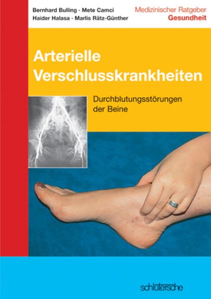 Arterielle Verschlusskrankheiten: Durchblutungsstörungen der Beine Health, Nutrition & Fitness