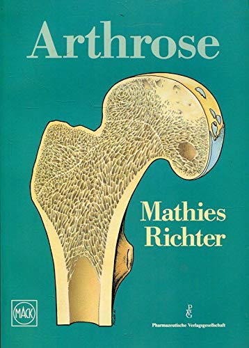 Arthrose am Beispiel des Hüftgelenkes Books