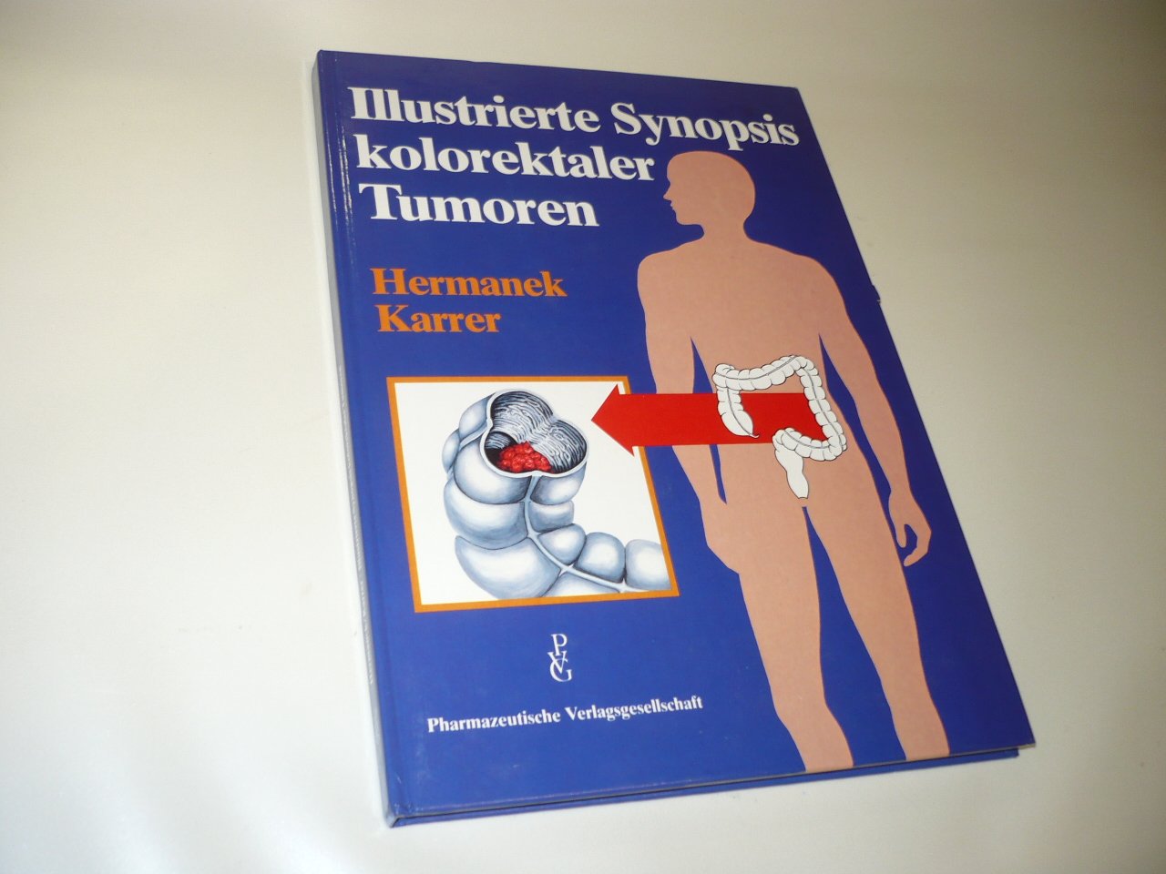 Illustrierte Synoppsis kolorektaler Tumoren Books