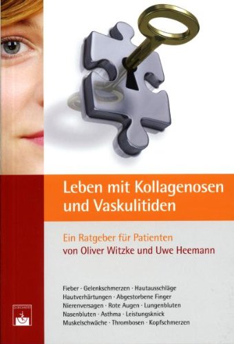 Leben mit Kollagenosen und Vaskulitiden book