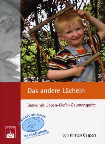 Das andere Lächeln. Babys mit Lippen-Kiefer-Gaumenspalte Health, Nutrition & Fitness