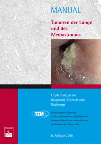Tumoren der Lunge und des Mediastinums: Empfehlungen zur Diagnostik, Therapie und Nachsorge (Manuale Tumorzentrum München) Medicine