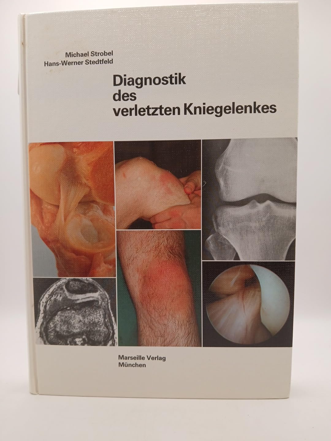 Diagnostik des verletzten Kniegelenkes Medicine
