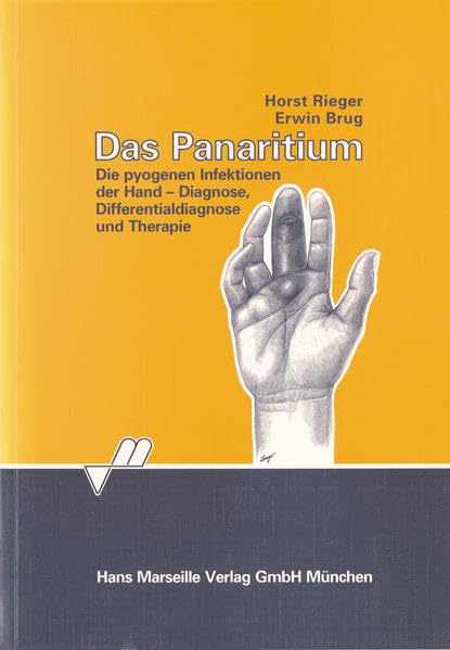 Das Panaritium: Die pyogenen Infektionen der Hand - Diagnose, Differentialdiagnose und Therapie Medicine