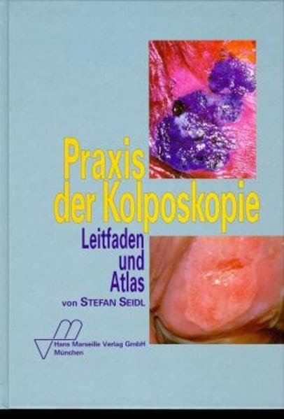 Praxis der Kolposkopie: Leitfaden und Atlas Medicine