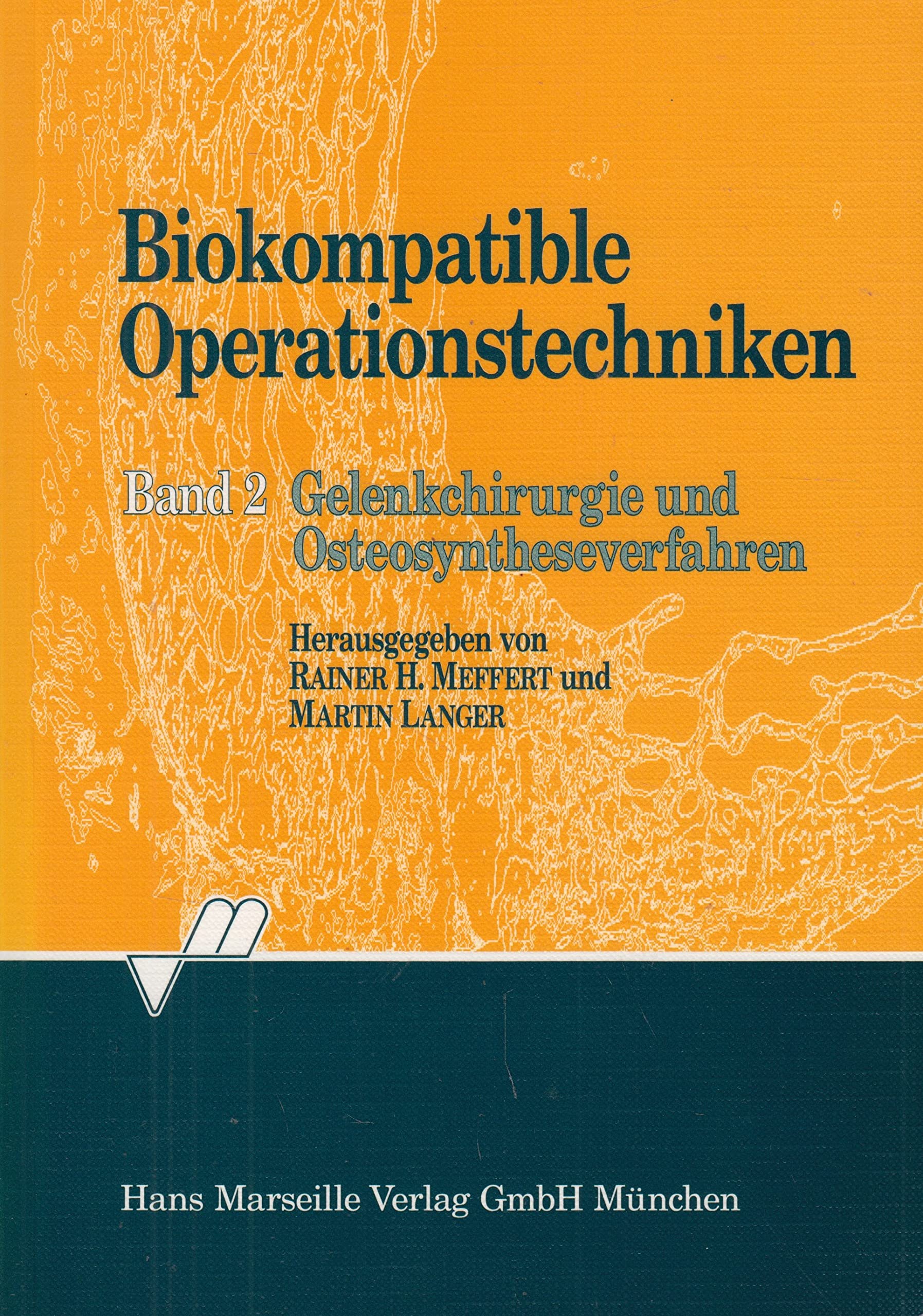 Biokompatible Operationstechniken Bd.2 : Gelenkchirurgie und Osteosyntheseverfahren Medicine