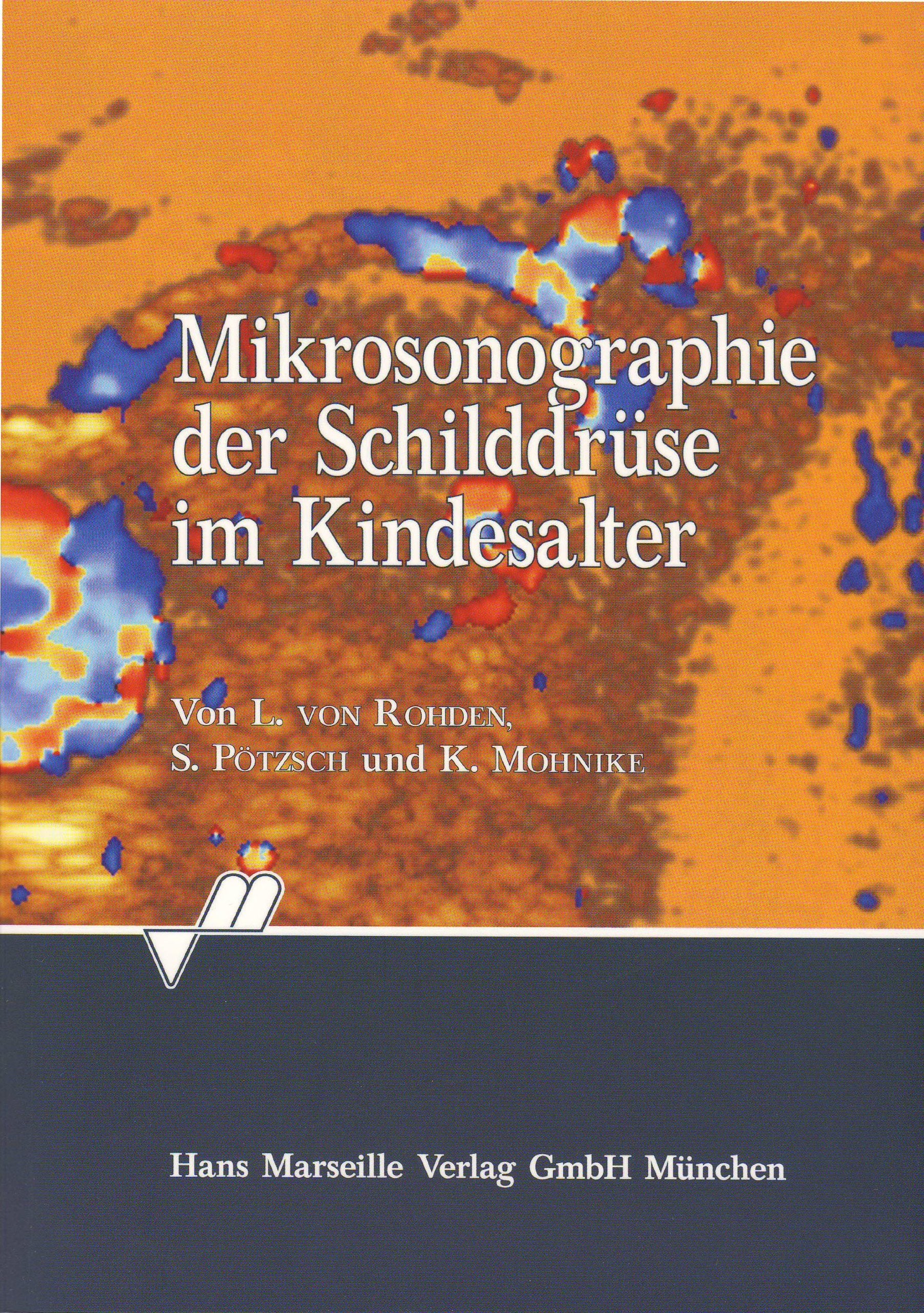 Mikrosonographie der Schilddrüse im Kindesalter Books