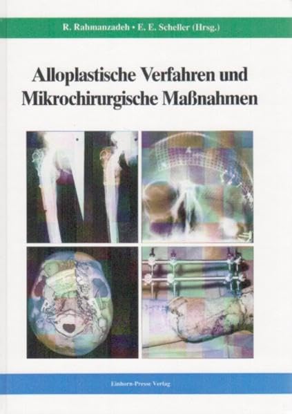 Alloplastische Verfahren und mikrochirurgische Massnahmen Medicine