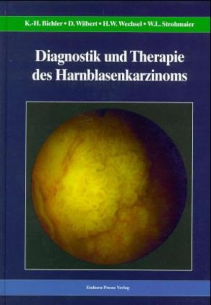 Diagnostik und Therapie des Harnblasenkarzinoms Medicine