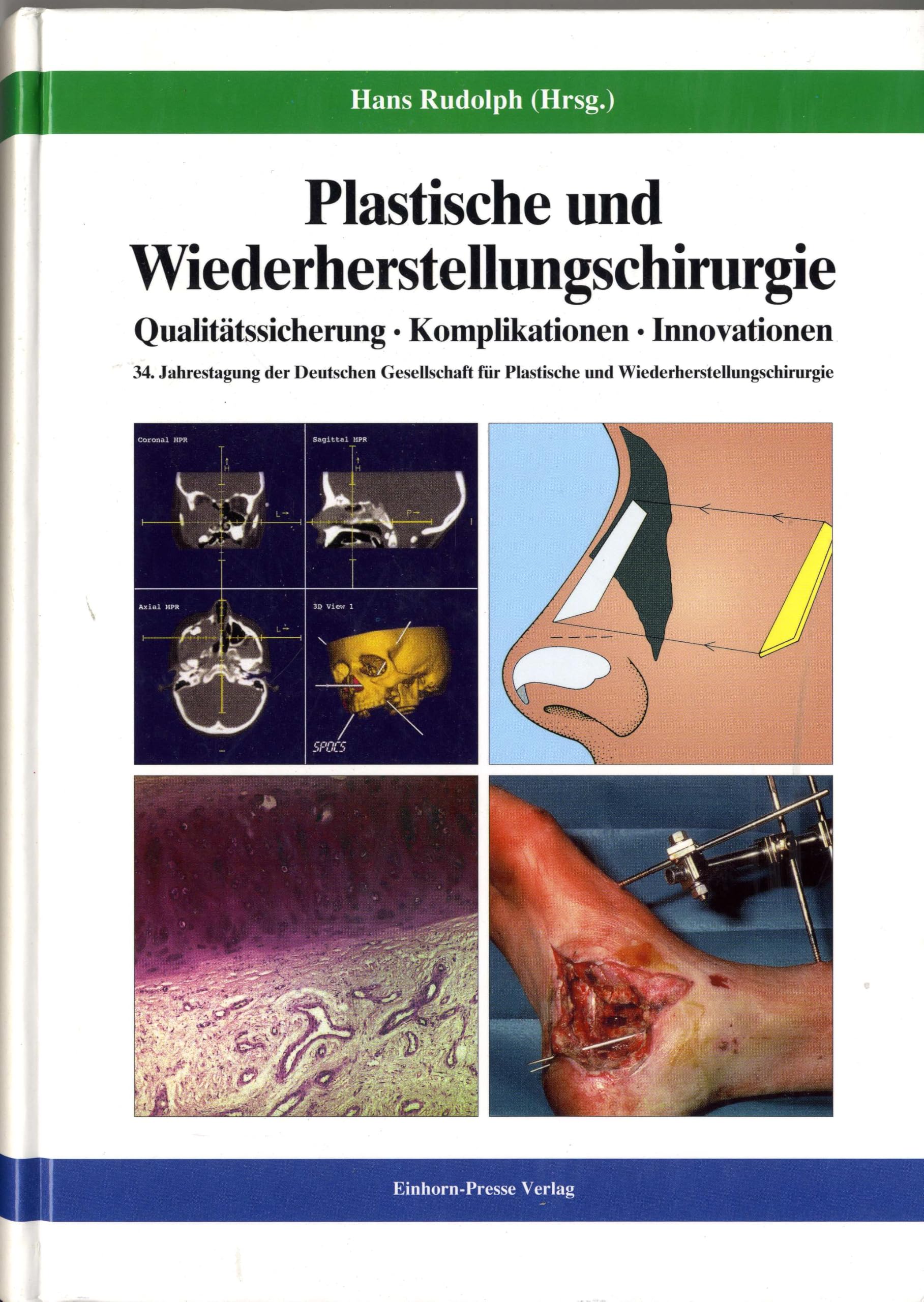 Plastische und Wiederherstellungschirurgie: Qualitätssicherung, Komplikationen, Innovationen: 34. Jahrestagung d. Dtsch. Ges. f. Plastische u. Wiederherstellungschirurgie Medicine