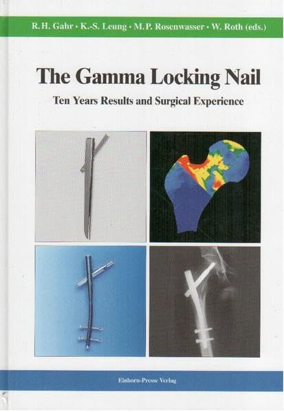The Gamma Locking Nail: Ten Years Results and Surgical Experience Medicine