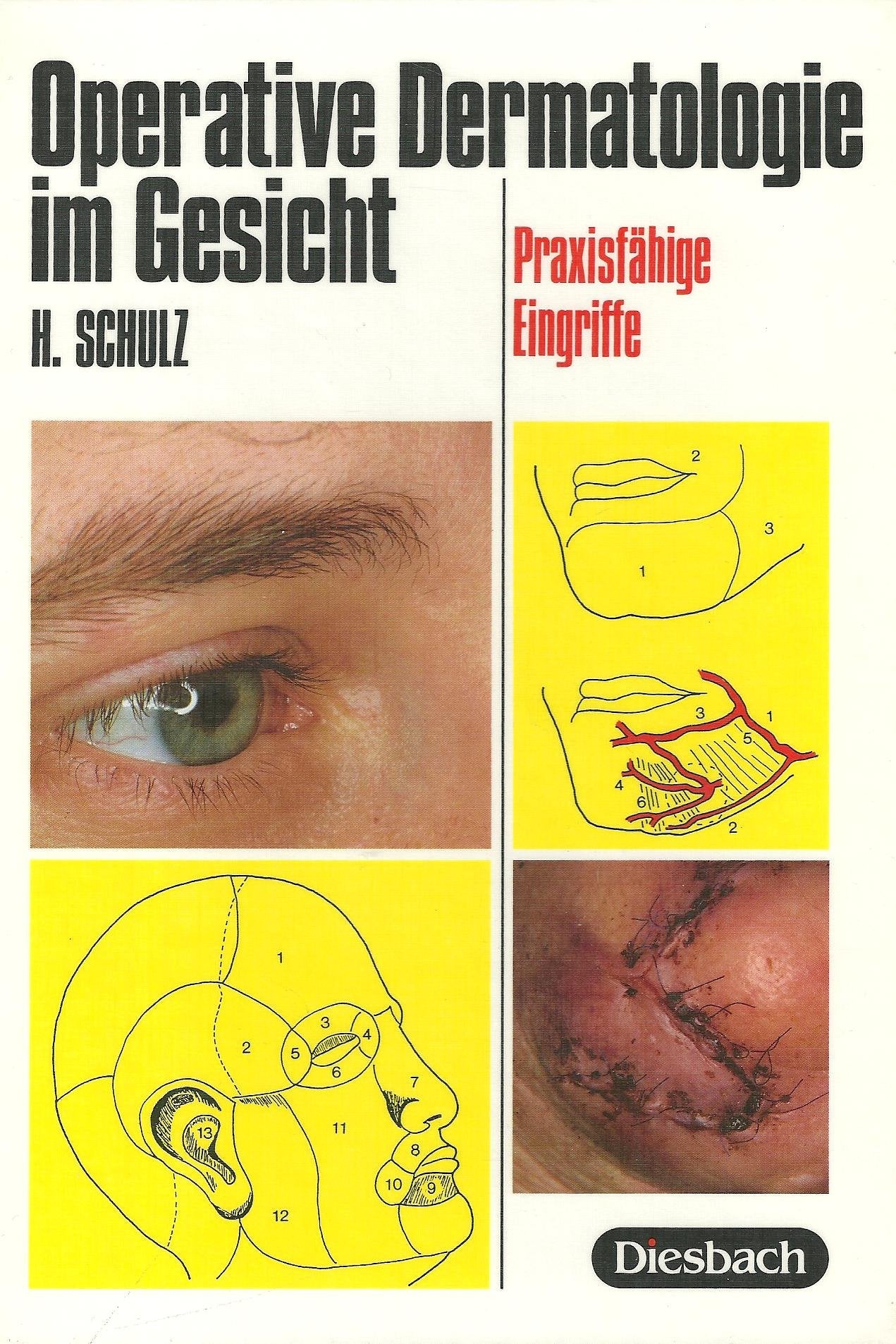 Operative Dermatologie im Gesicht: Praxisfähige Eingriffe Medicine