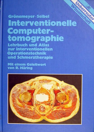 Interventionelle Computertomographie Medicine