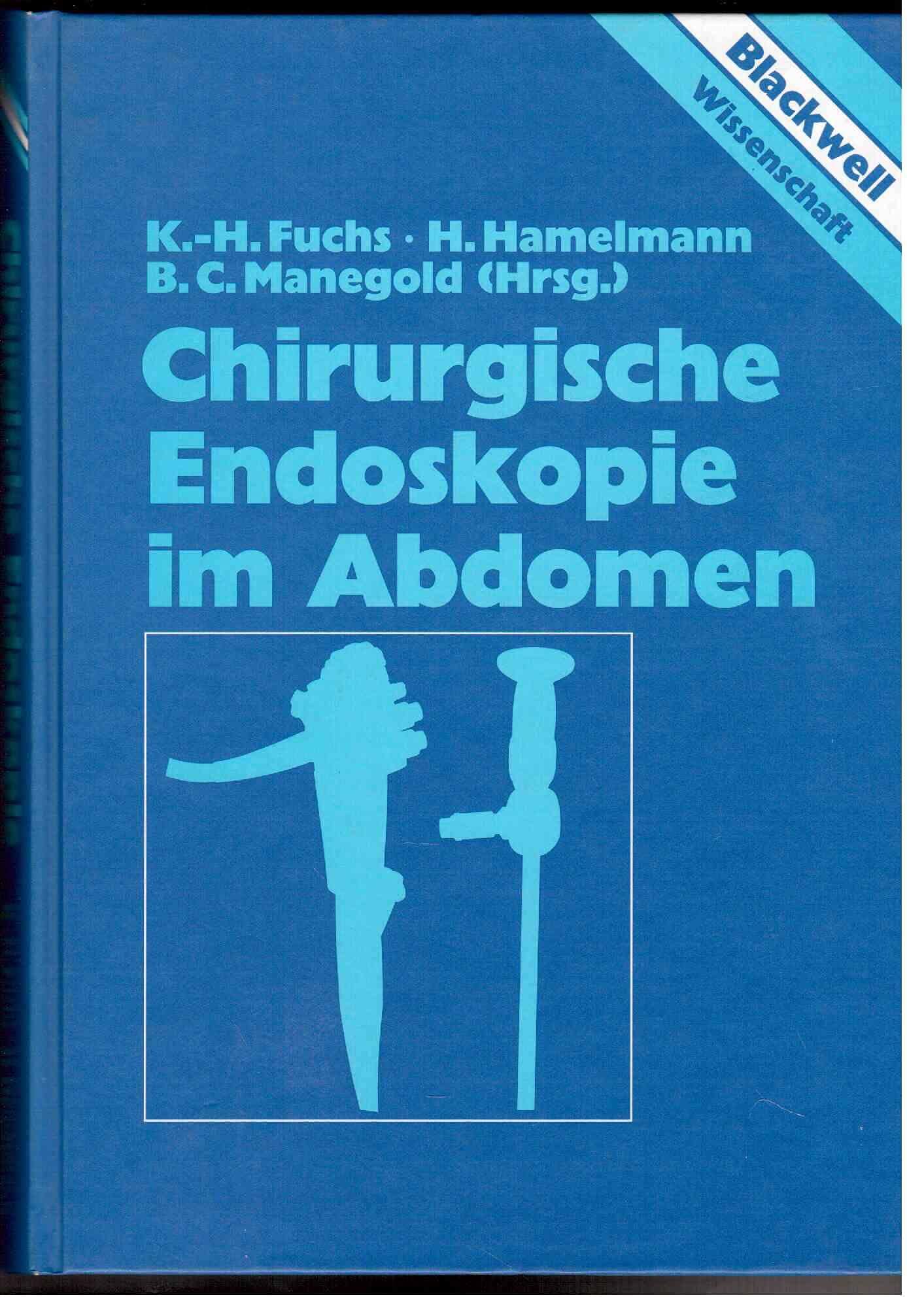 Chirurgische Endoskopie im Abdomen Medicine