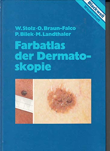 Farbatlas der Dermatoskopie Medicine