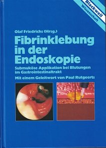 Fibrinklebung in der Endoskopie Medicine Books