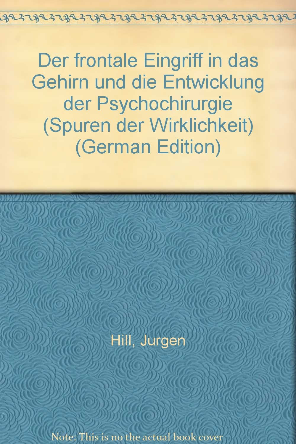 Der frontale Griff in das Gehirn und die Entwicklung der Psychochirurgie: Eine symptomatische Betrachtung der Psychochirurgie Books
