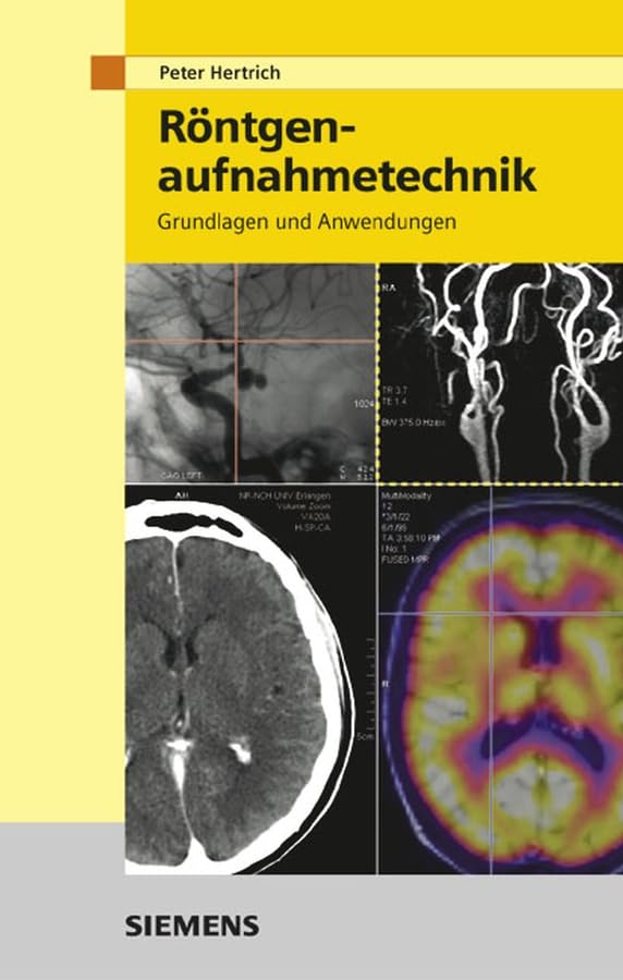 Röntgenaufnahmetechnik: Grundlagen und Anwendungen Medicine