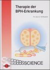 Therapie der BPH-Erkrankung Medicine