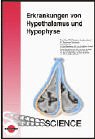 Erkrankungen von Hypothalamus und Hypophyse Medicine