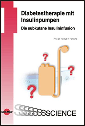 Diabetestherapie mit Insulinpumpen. Die subkutane Insulininfusion Medicine