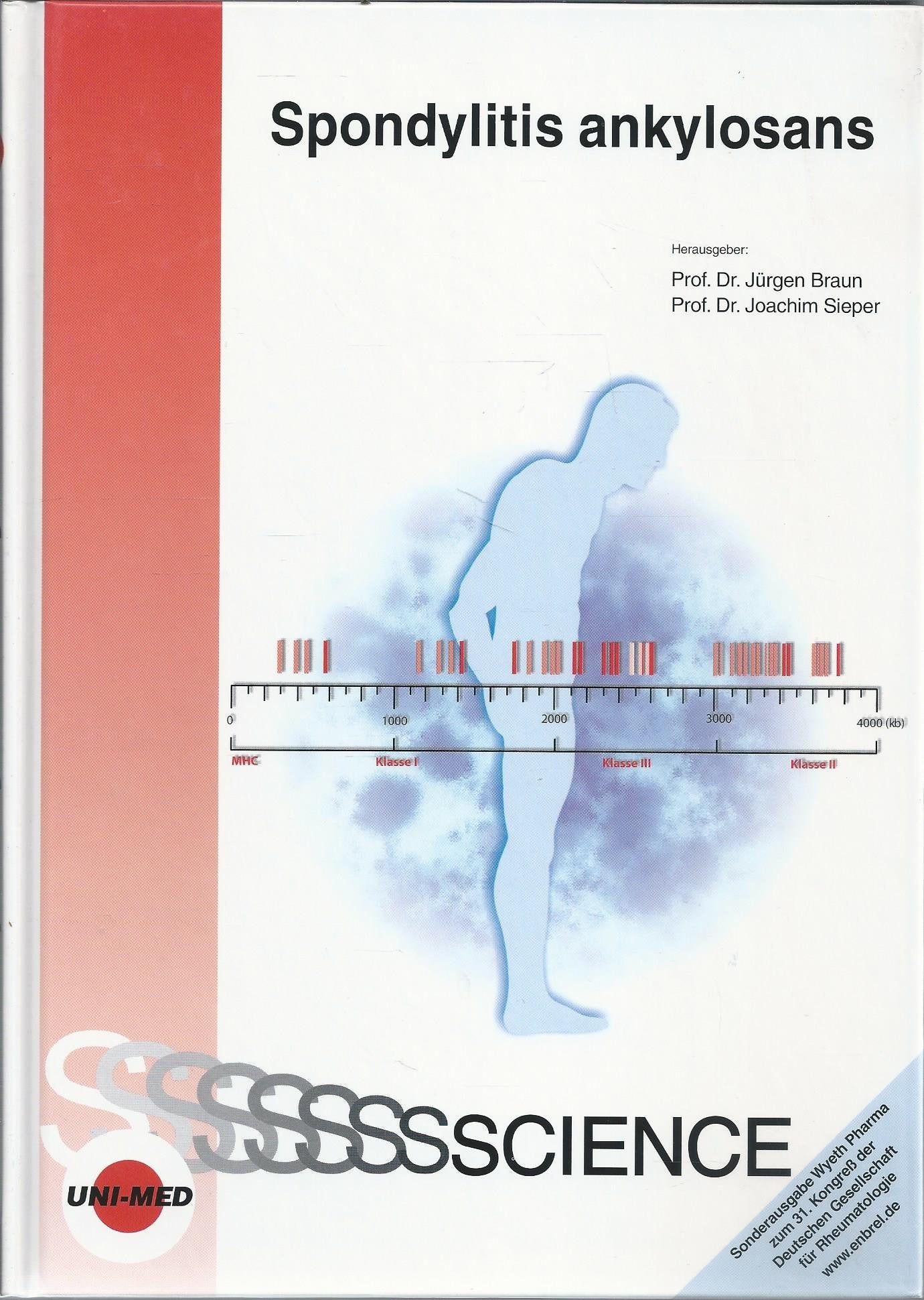 Product Image: Spondylitis ankylosans