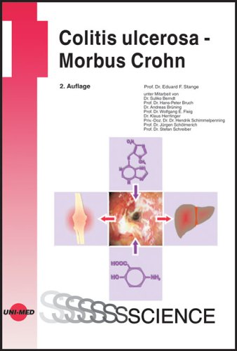 Colitis ulcerosa - Morbus Crohn Medicine