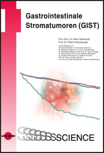 Gastrointestinale Stromatumoren (GIST) Medicine