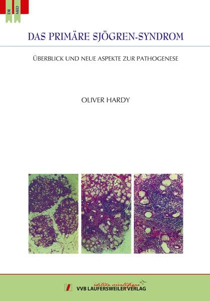 Das primäre Sjögren-Syndrom: Überblick und neue Aspekte zur Pathogenese (Edition Scientifique) Medicine